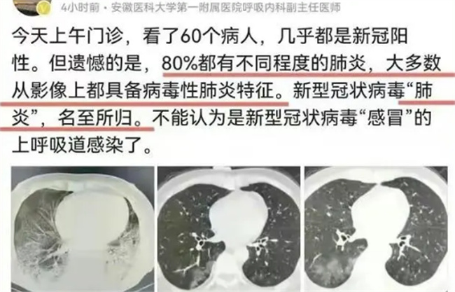 阳了怎么知道肺部是否感染新冠“阳”了怎么判断肺部有没有感染(新冠感染后磨玻璃肺部结节是怎么回事)